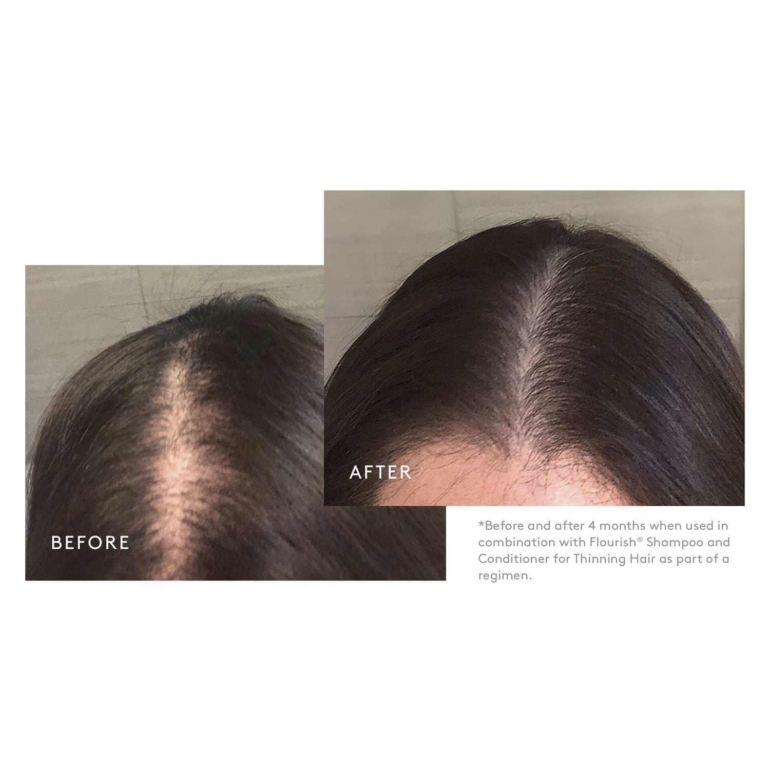 Virtue - Flourish® Minoxidil 5% Foam for Hair Growth - Image 2