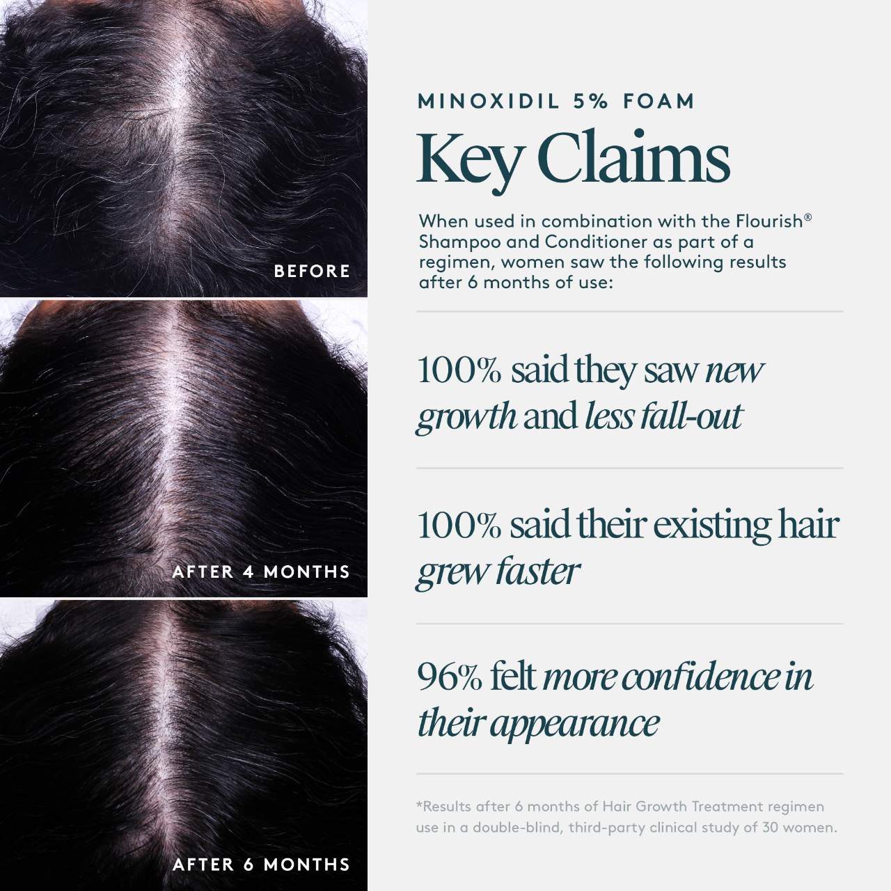 Virtue - Flourish® Minoxidil 5% Foam for Hair Growth - Image 4