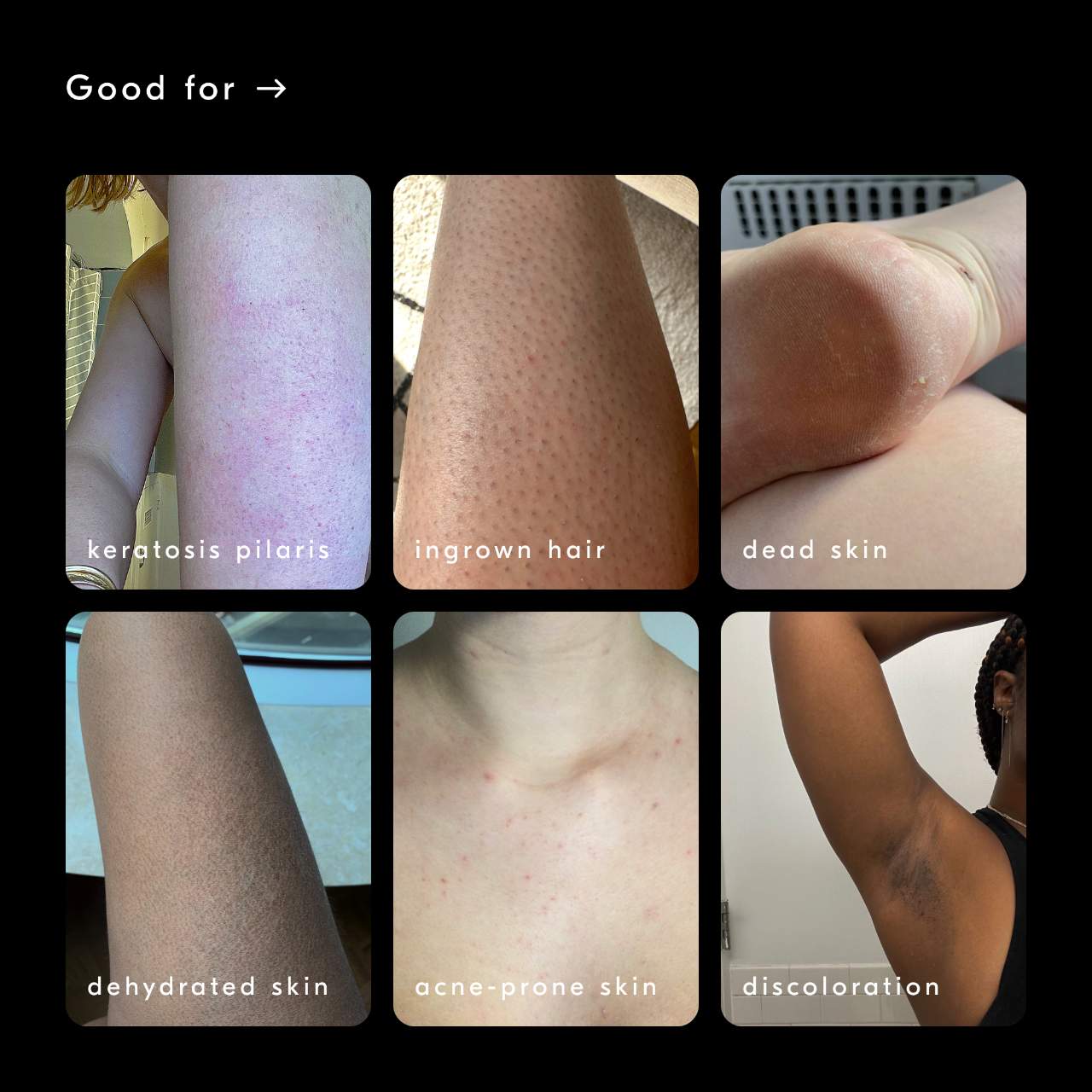 Soft Services - the body skin experts™ Bestsellers Discovery Set - Image 3
