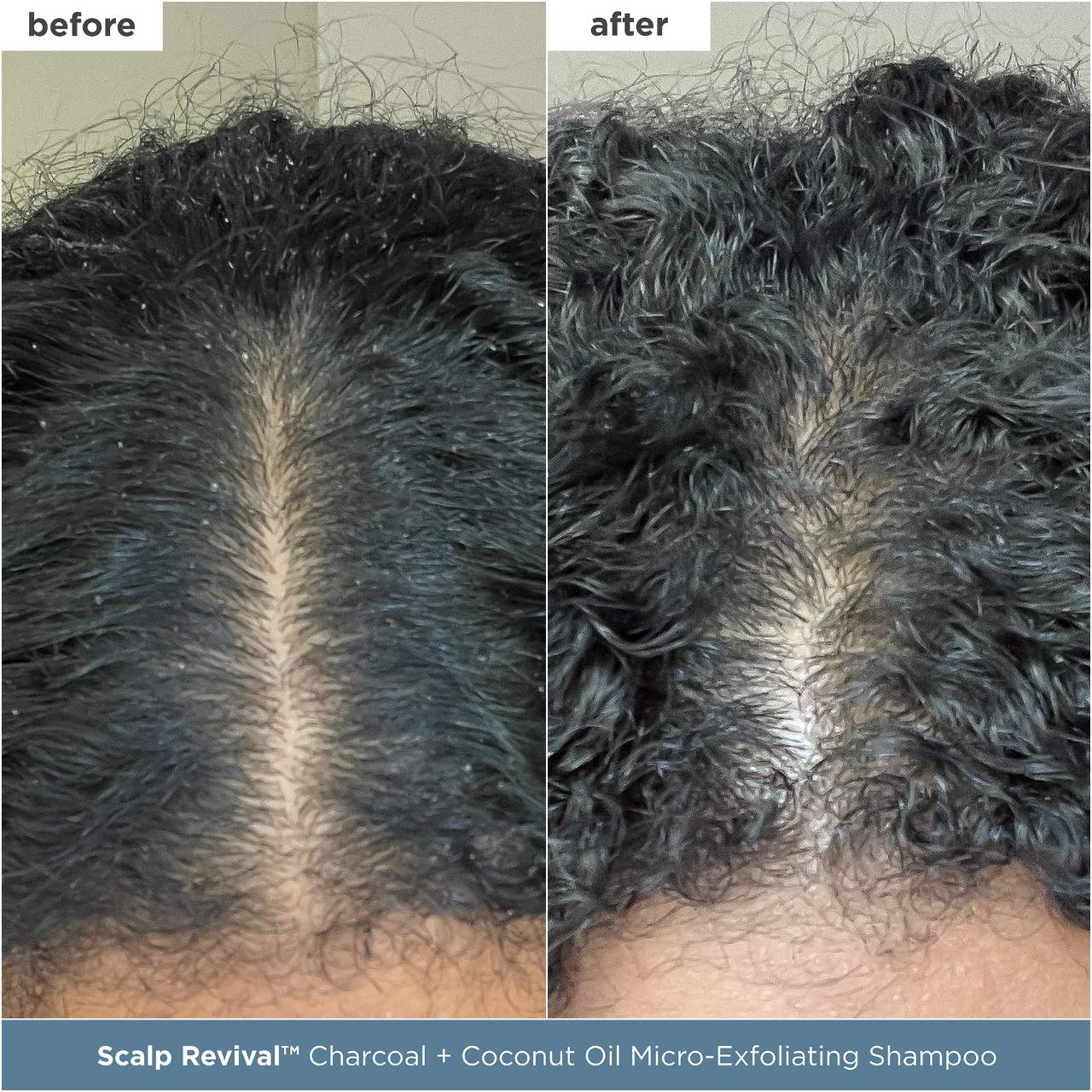 Briogeo - Scalp Revival™ Moisture + Detox + Refresh Minis Kit for Dry, Flaky Scalp - Image 2