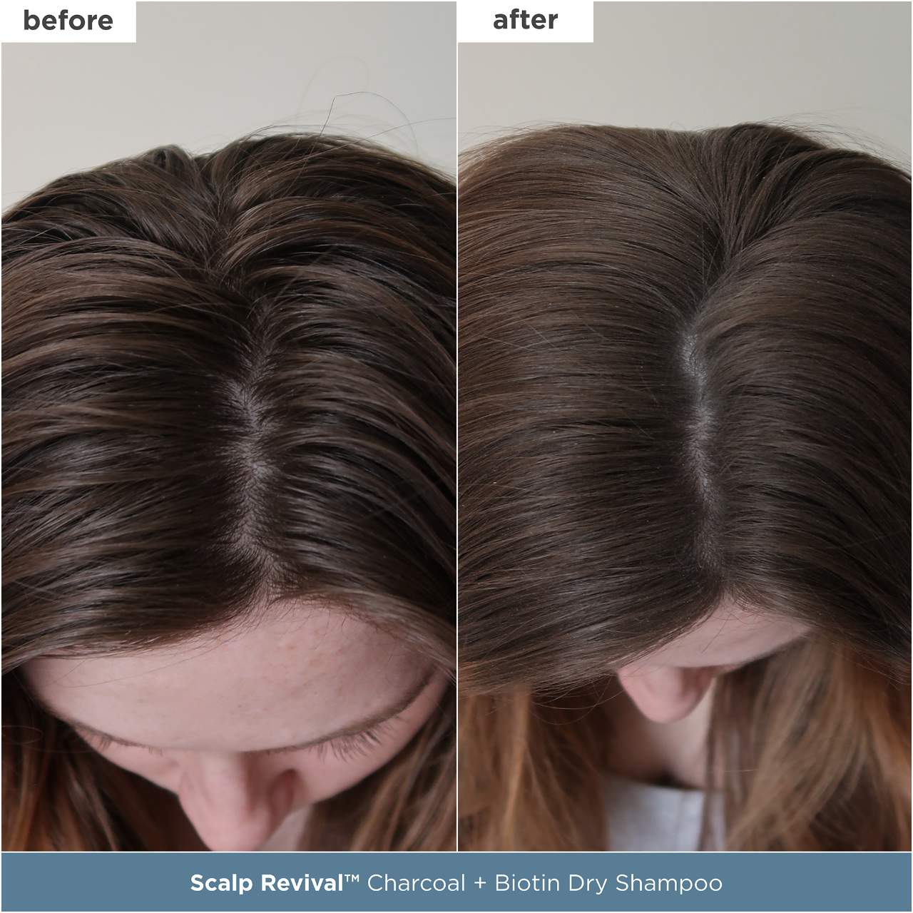 Briogeo - Scalp Revival™ Moisture + Detox + Refresh Minis Kit for Dry, Flaky Scalp - Image 4