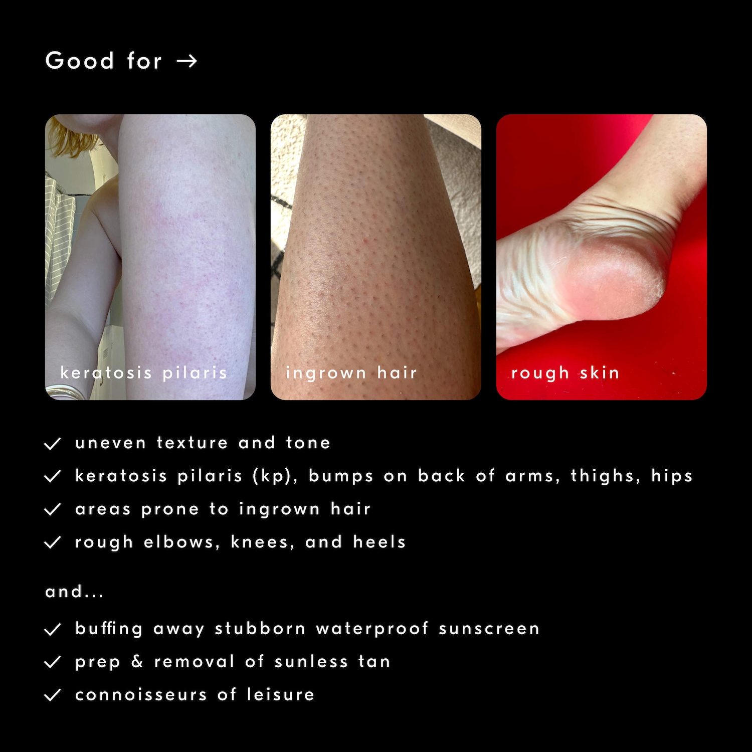 Soft Services - Soft Services x Vacation® — "VACATION" Buffing Bar Exfoliating Body Bar (2-pack) with Coconut, Pineapple & Solar Notes - Image 3