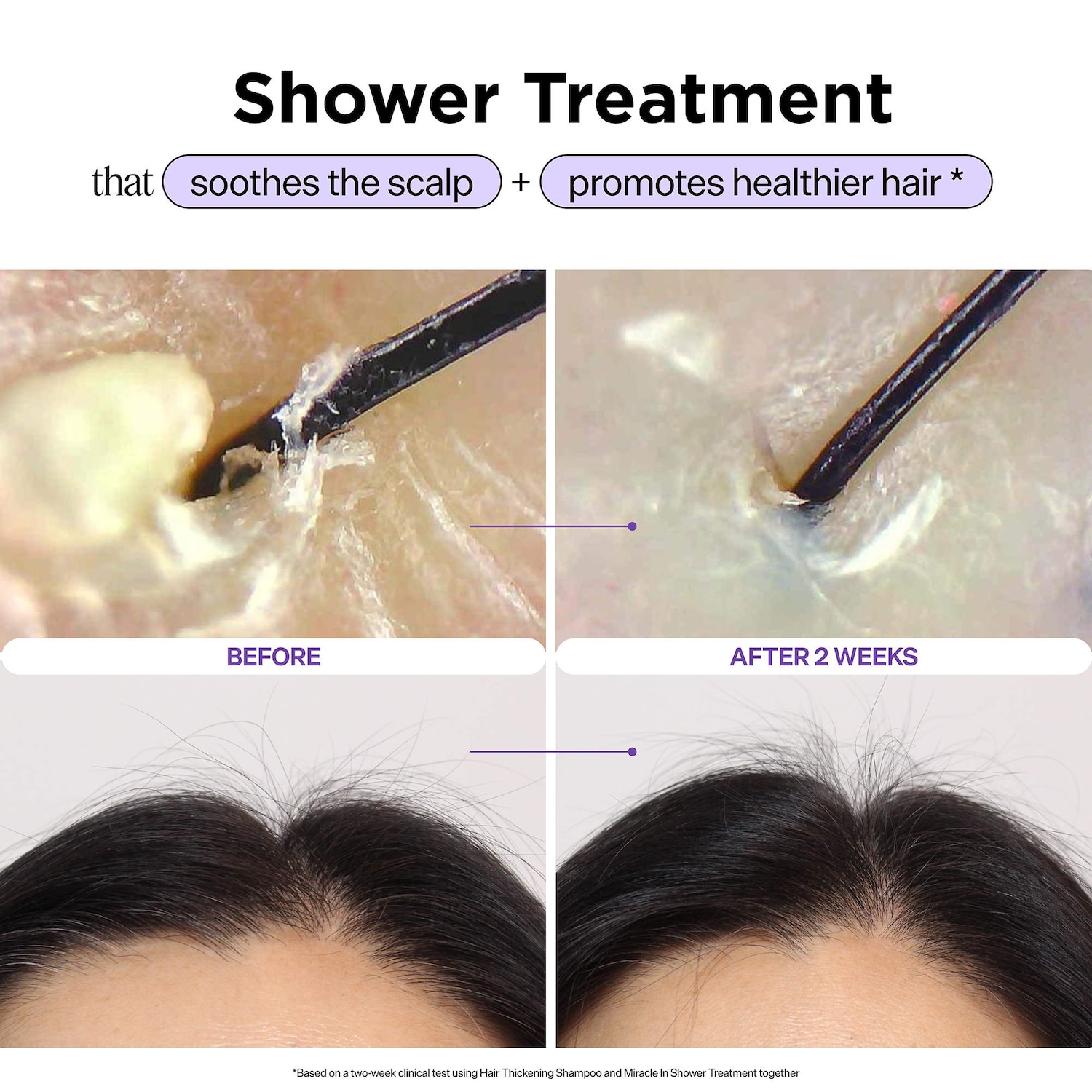 Dr. Groot – Miracle In Shower Scalp & Hair Hydrating Treatment for Hair Thinning