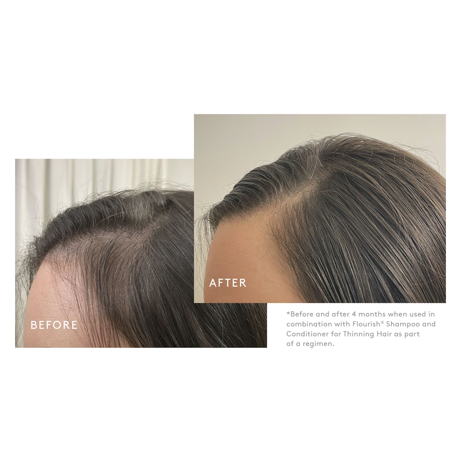 Virtue – Flourish&reg; Density Booster for Healthy Hair Growth