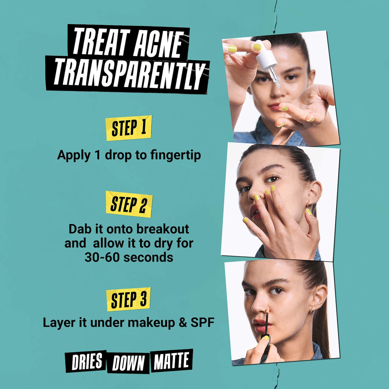 Kiehl's Since 1851 - Truly Targeted Acne-Clearing Liquid Pimple Patch with Salicylic Acid - Image 3
