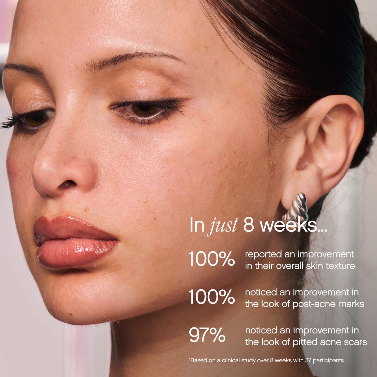Topicals - Sealed Active Scar Filling Primer for Acne Prone Skin - Image 2