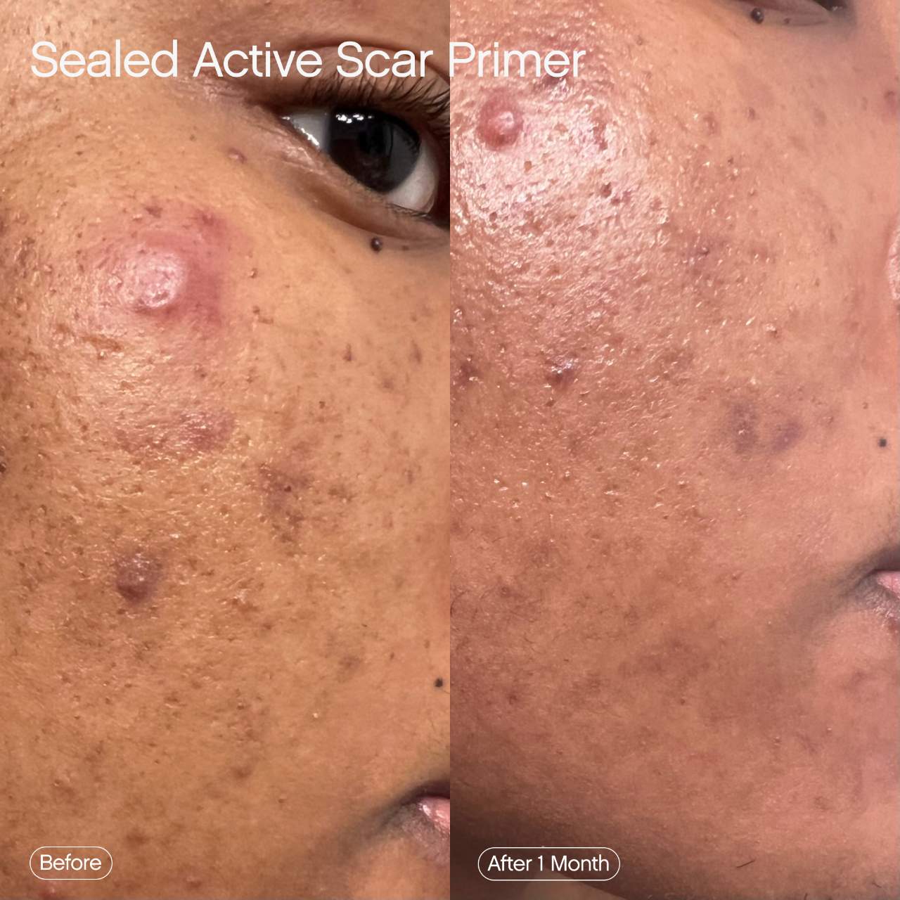 Topicals - Sealed Active Scar Filling Primer for Acne Prone Skin - Image 4