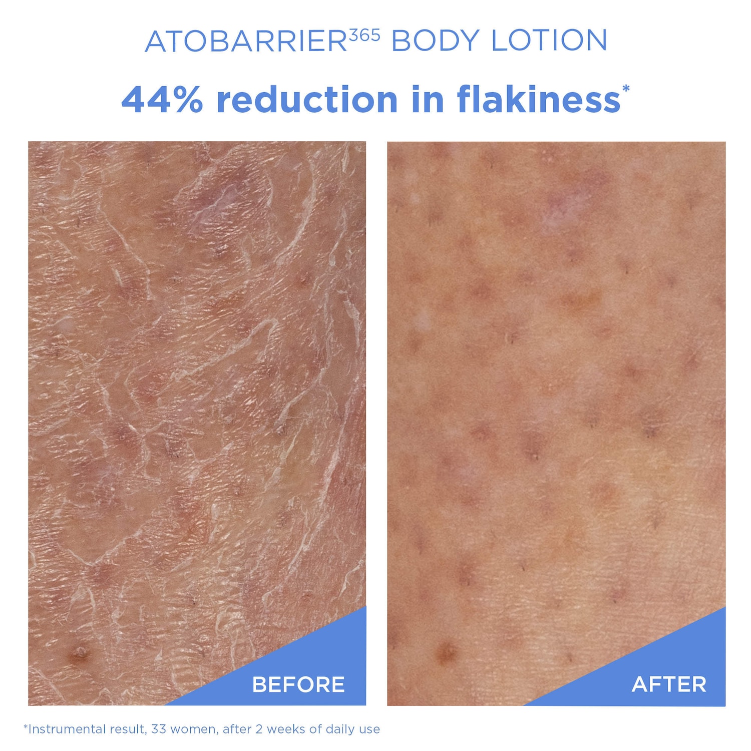 AESTURA - ATOBARRIER365 Moisturizing Body Lotion with Ceramides for Dry & Sensitive Skin - Image 2