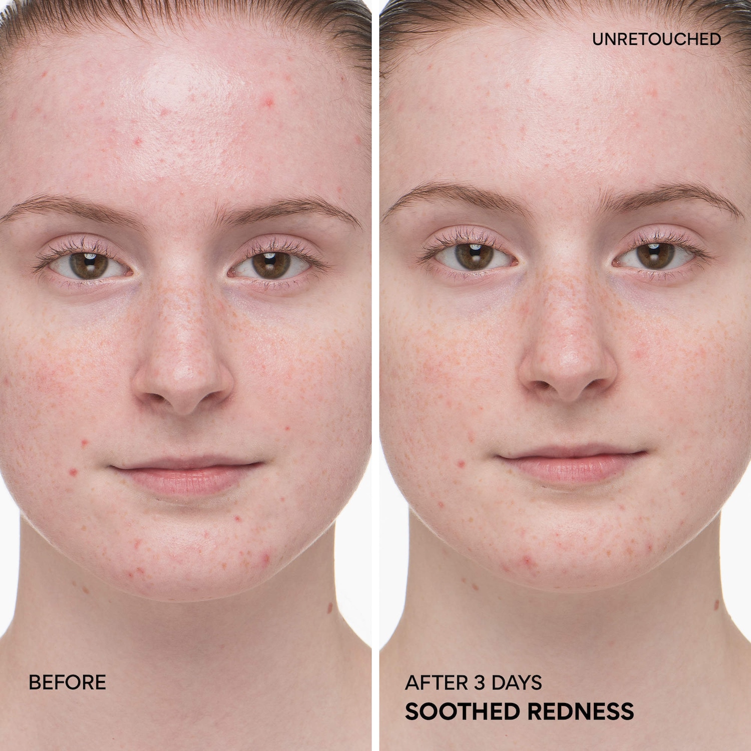 innisfree - Green Tea Ceramide Refillable Korean Milk Toner for Hydration & Barrier Repair - Image 2
