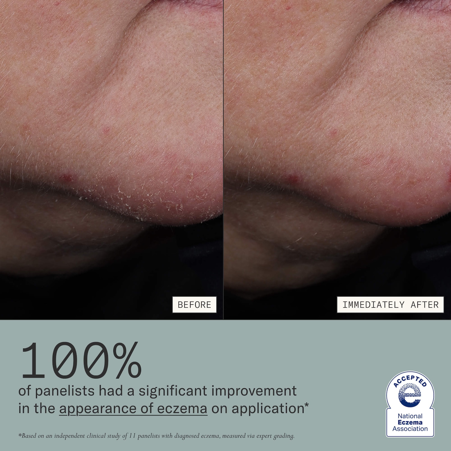 Dieux - Skin Mercy Intense Recovery Cream for Sensitive & Eczema-Prone Skin - Image 2