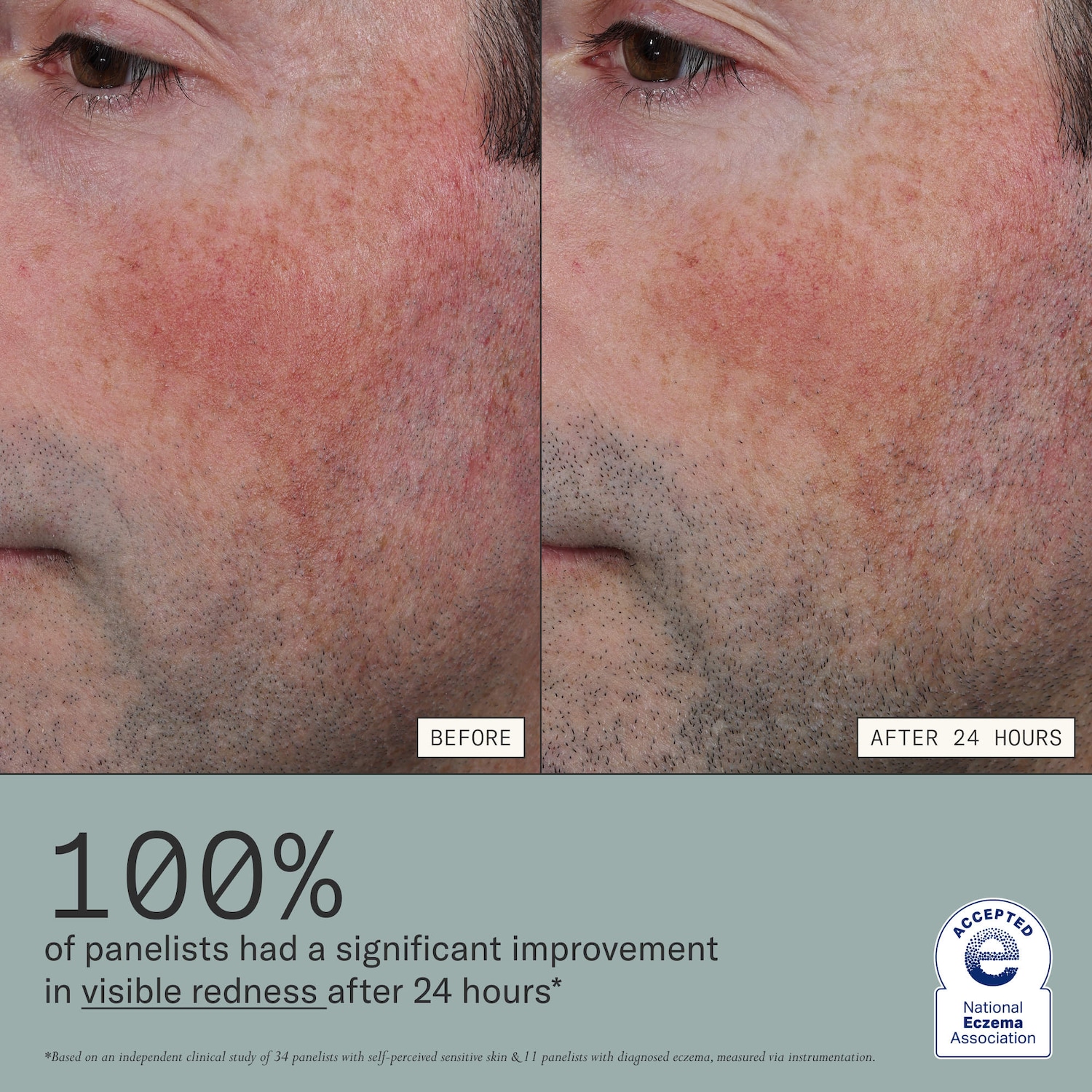 Dieux - Skin Mercy Intense Recovery Cream for Sensitive & Eczema-Prone Skin - Image 3