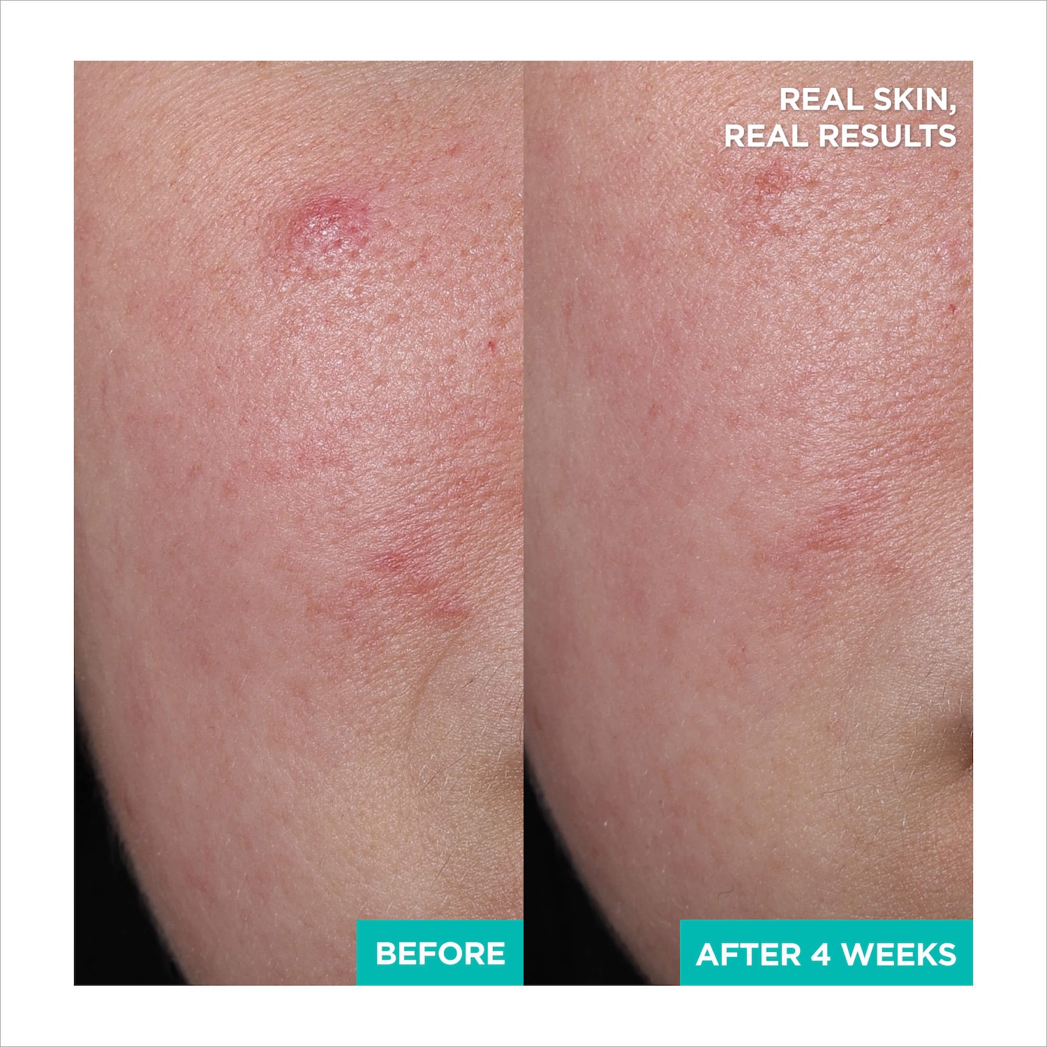 AESTURA - A-CICA365 Soothing Repair Gel Cream Moisturizer pH4.5 with Centella Asiatica + Panthenol for Redness - Image 2