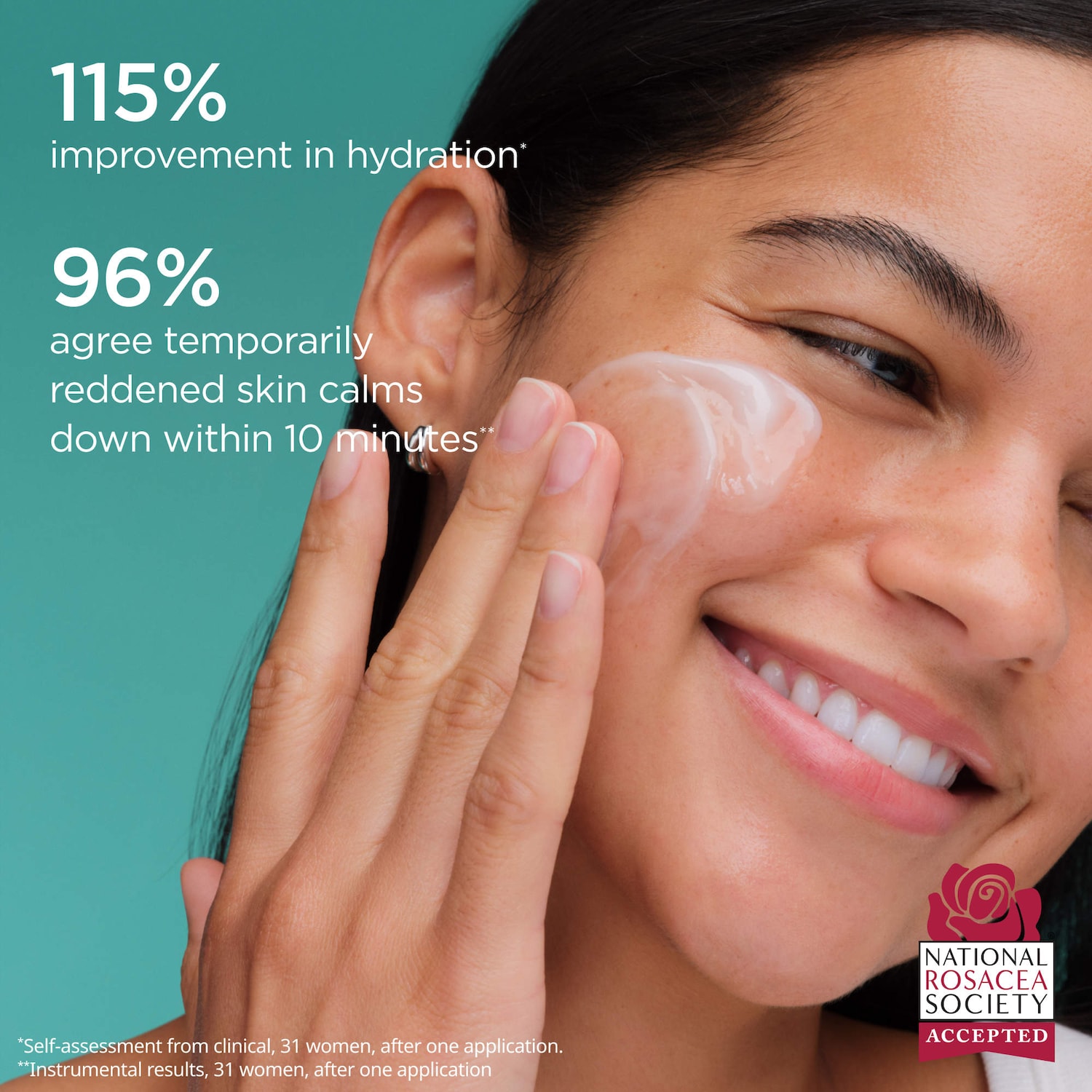 AESTURA - A-CICA365 Soothing Repair Gel Cream Moisturizer pH4.5 with Centella Asiatica + Panthenol for Redness - Image 3