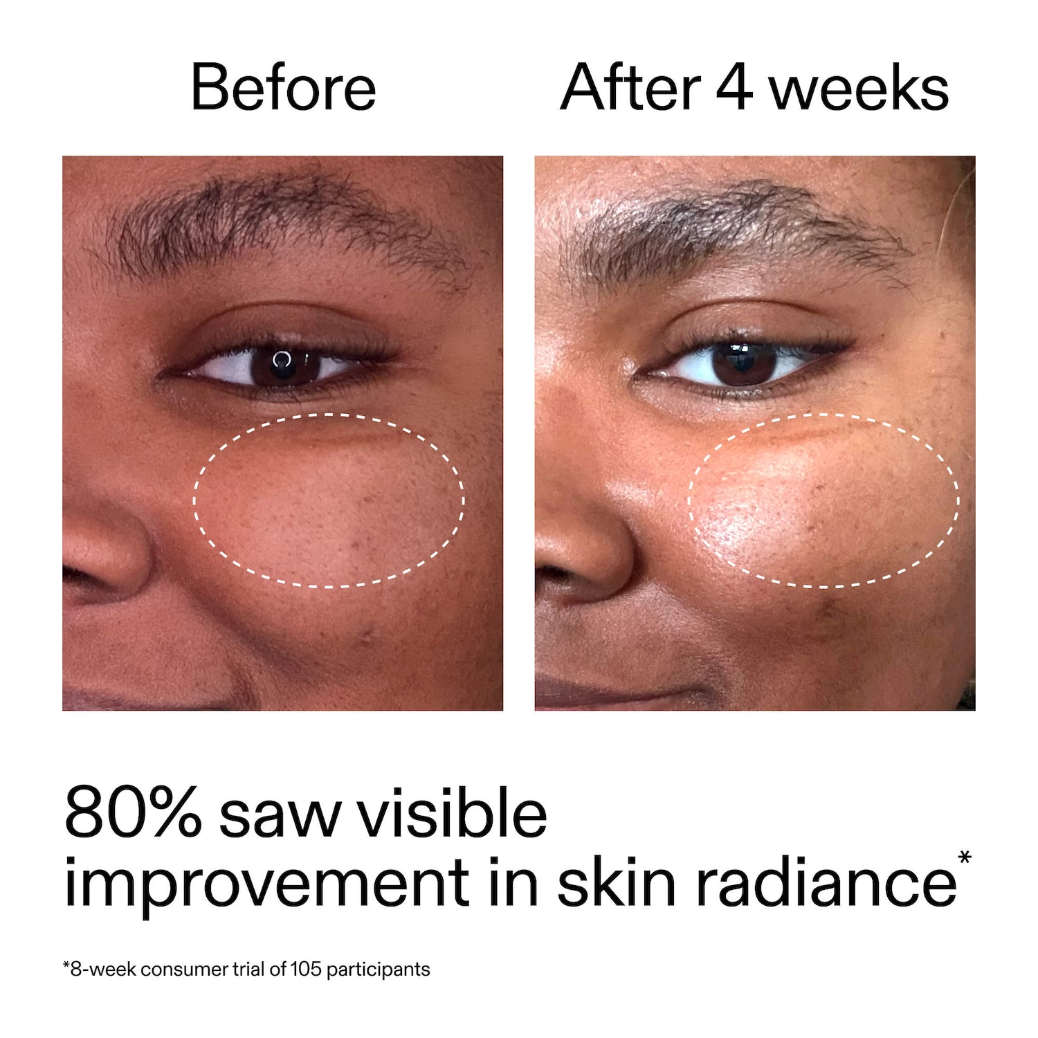 The INKEY List - Advanced Retinal Serum for Fine lines + Wrinkles - Image 3