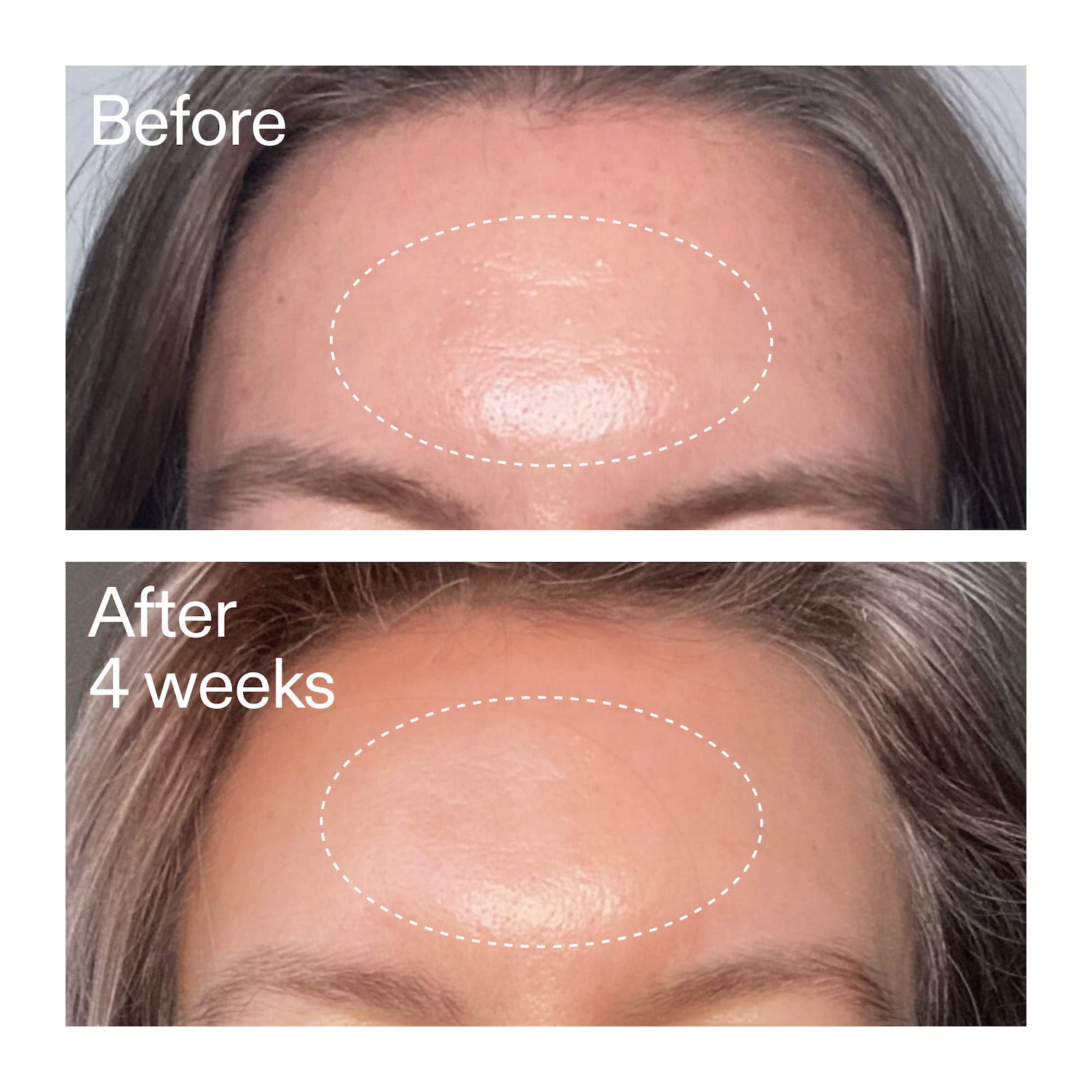 The INKEY List - Advanced Retinal Serum for Fine lines + Wrinkles - Image 4