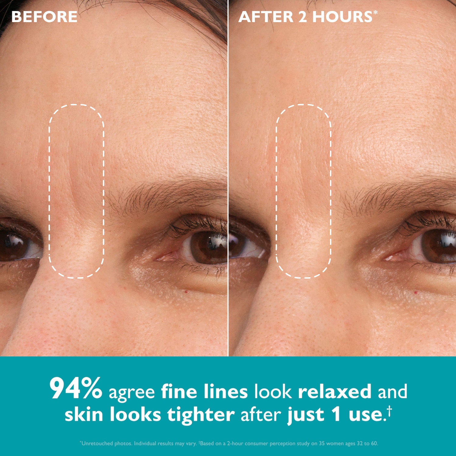Peter Thomas Roth – Peptide Skinjection™ Peptide-Infused Face & Eye Tape for Wrinkles and Aging Skin