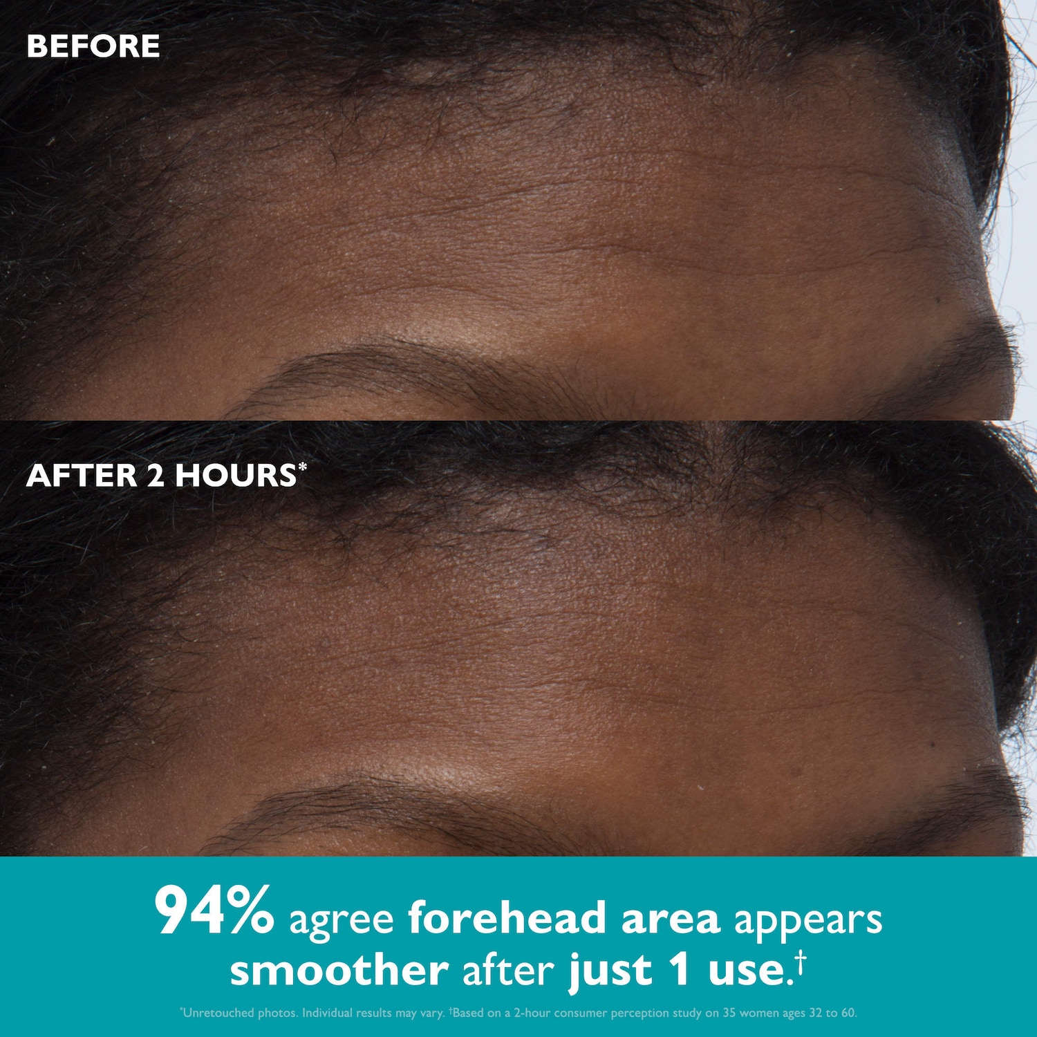 Peter Thomas Roth - Peptide Skinjection™ Peptide-Infused Face & Eye Tape for Wrinkles and Aging Skin - Image 3
