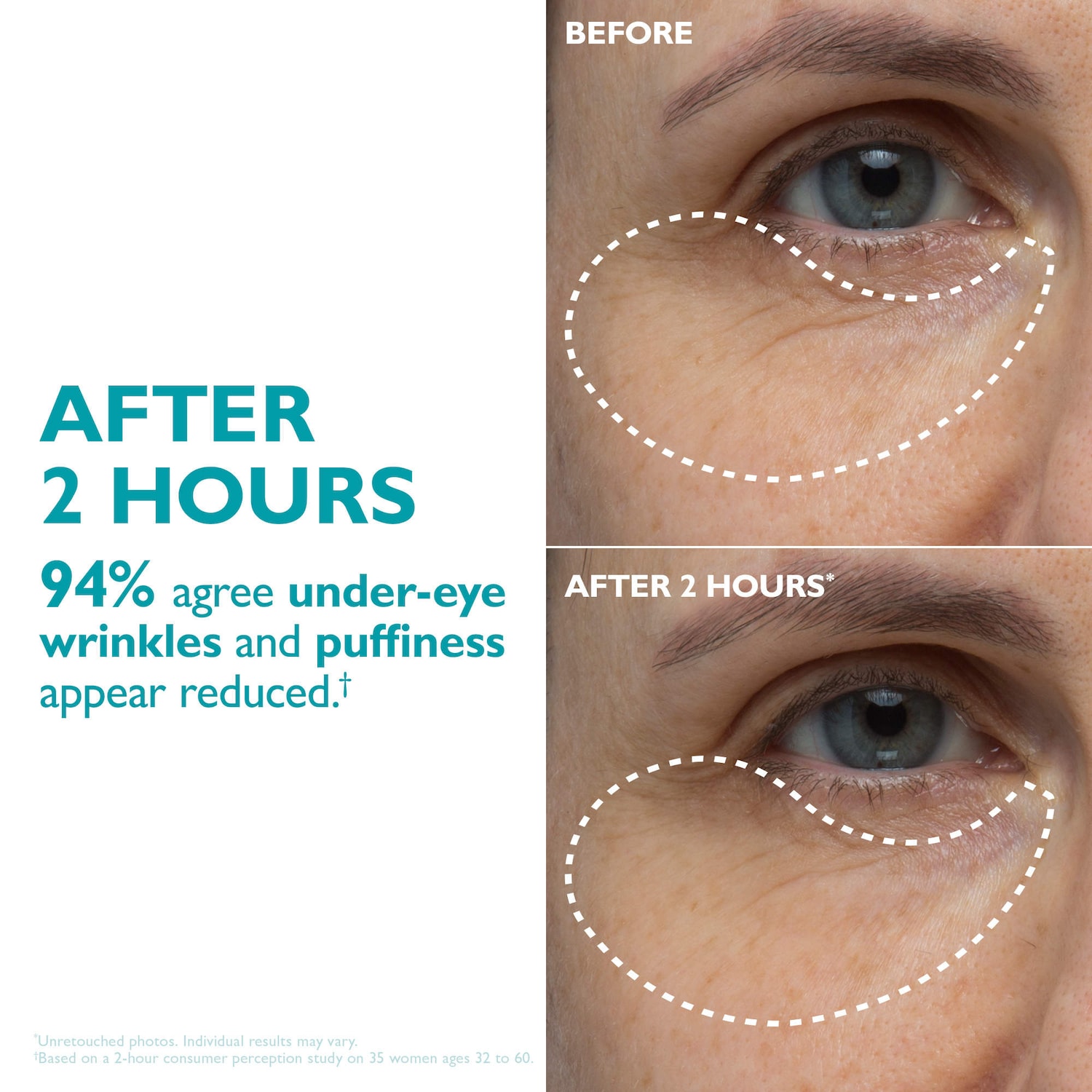 Peter Thomas Roth - Peptide Skinjection™ Peptide-Infused Face & Eye Tape for Wrinkles and Aging Skin - Image 5
